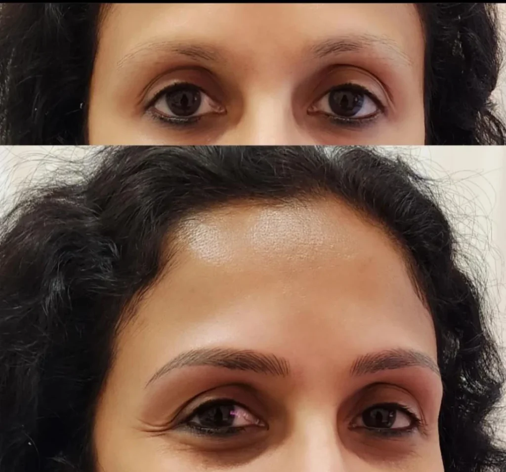microblading before-after