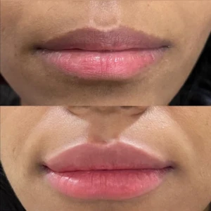 lip blush befor-after