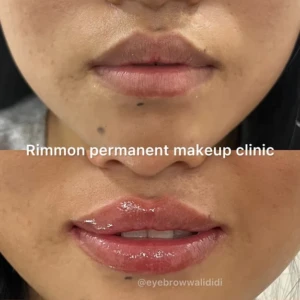 lip blush treatment before and after in Pune